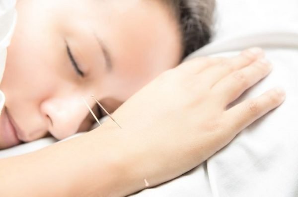 Akupunktur zayıflama tedavisi el bölgesi basınç noktaları