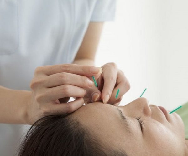 Akupunktur zayıflama tedavisi yüz bölgesi iğne basınç noktaları